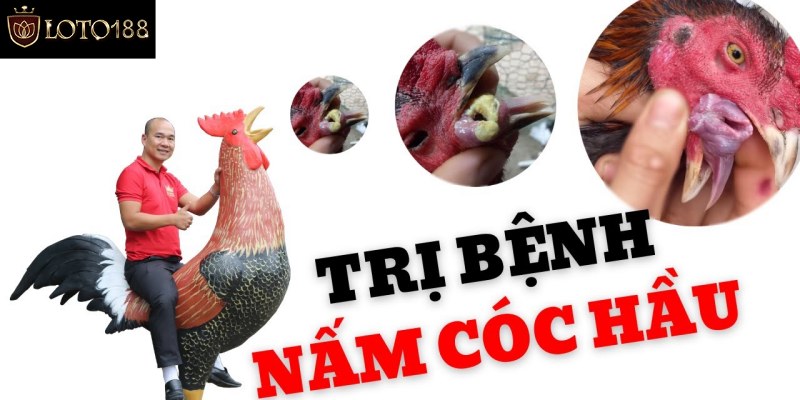 Bệnh nấm họng gà bằng thuốc dân gian cần lưu ý gì?
